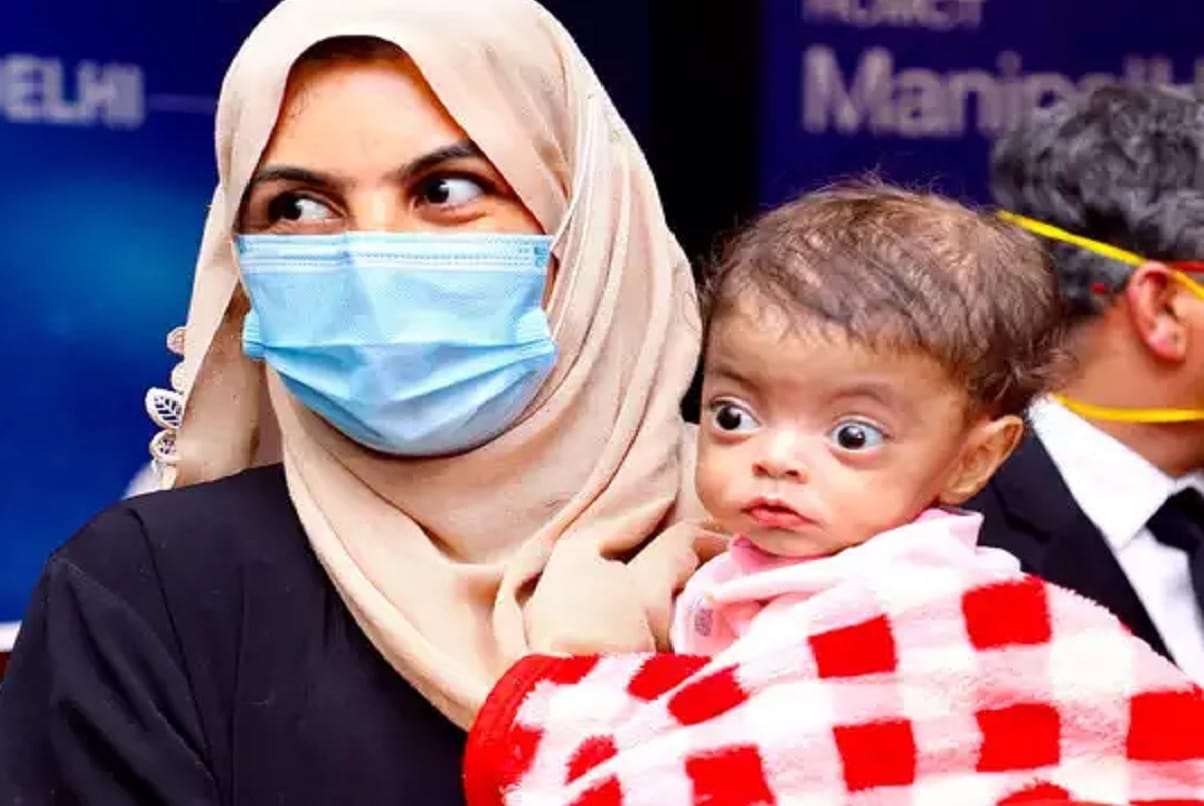 Delhi Doctors gave new life to a nine month old Iraqi child liver transplant done in nine hours