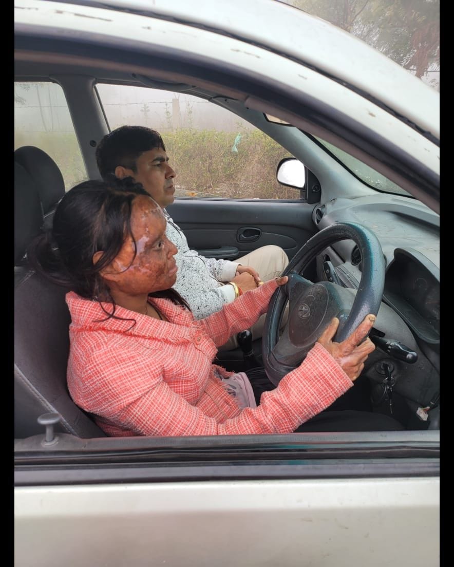 Mathura: Teaching driving to acid burn girls