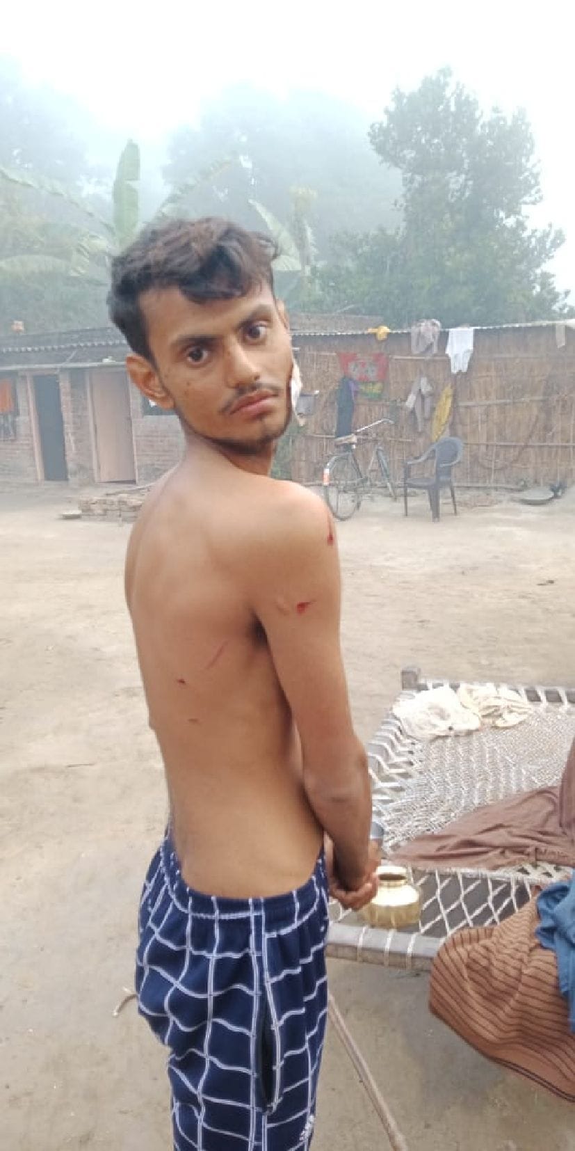 Student injured in leopard attack