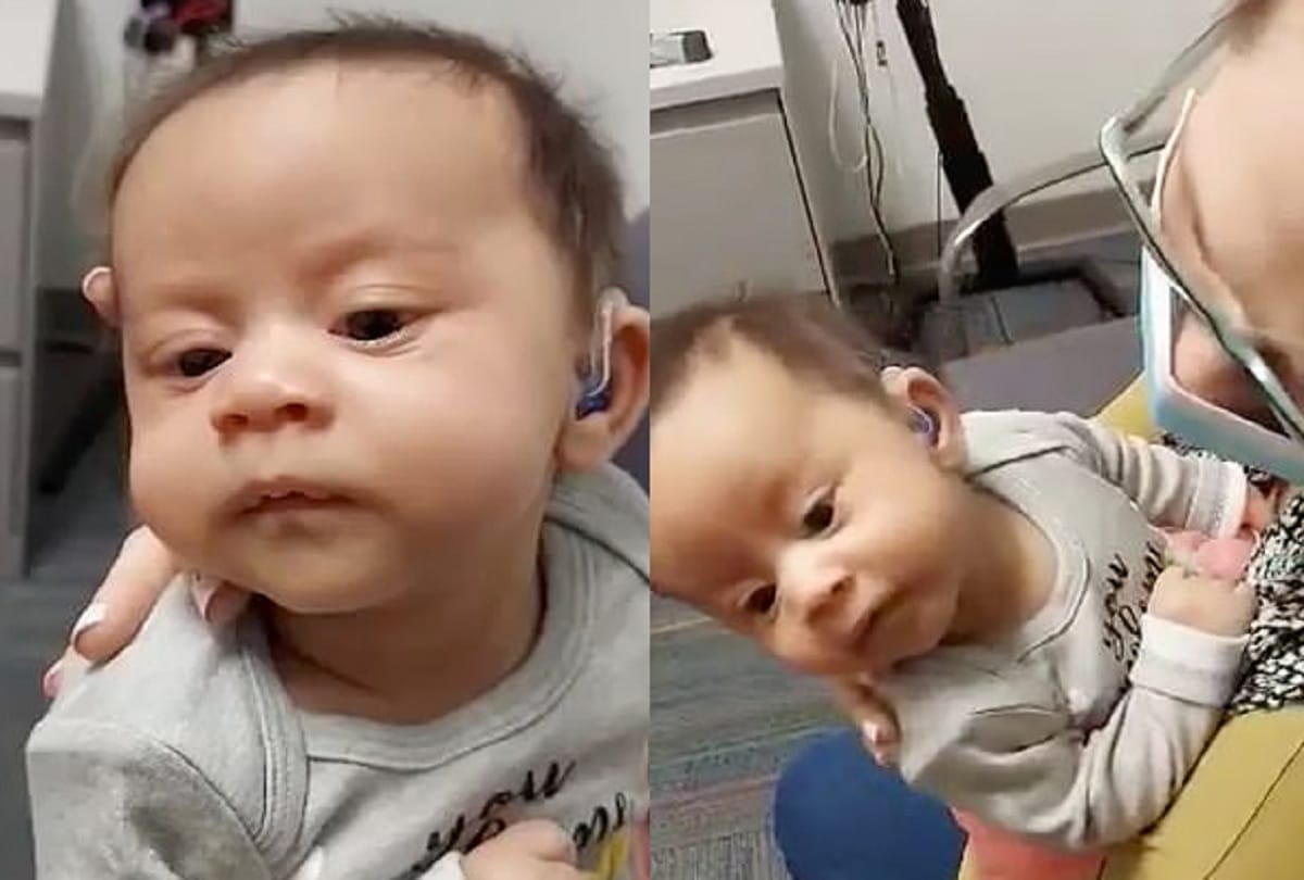 three month old a deaf baby hears her mother singing first time