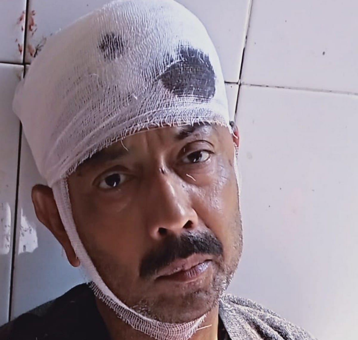 Man died during treatment in hospital beaten by people for money transaction dispute in Jaunpur
