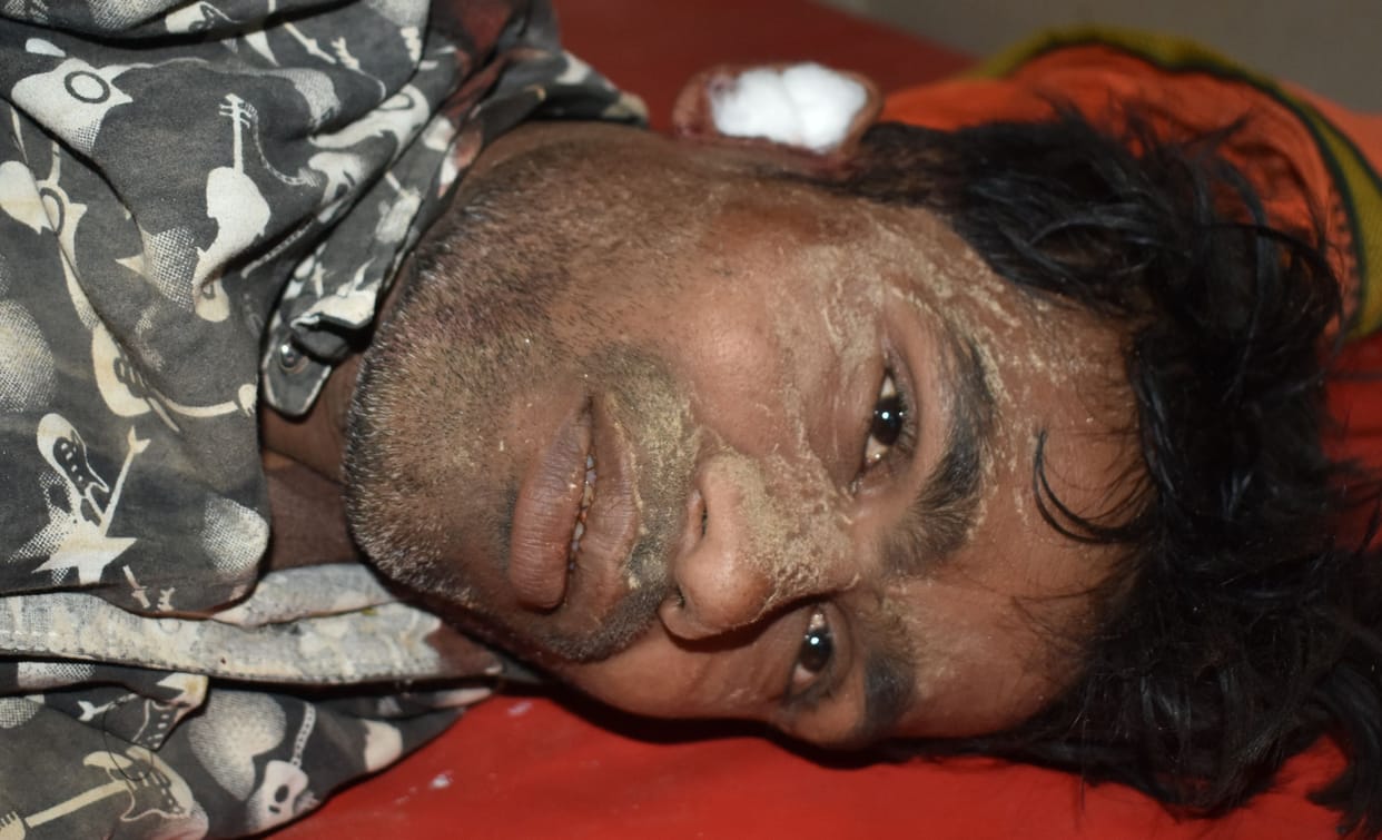 accident,teenager,dead,fathepur news,crushed by truck