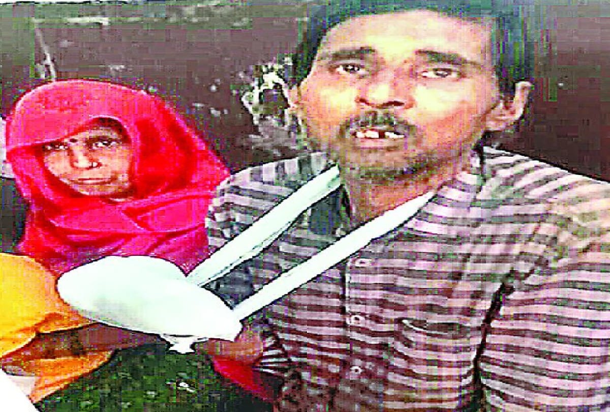 doctors thumb in replace of finger during surgery at SN Medical College