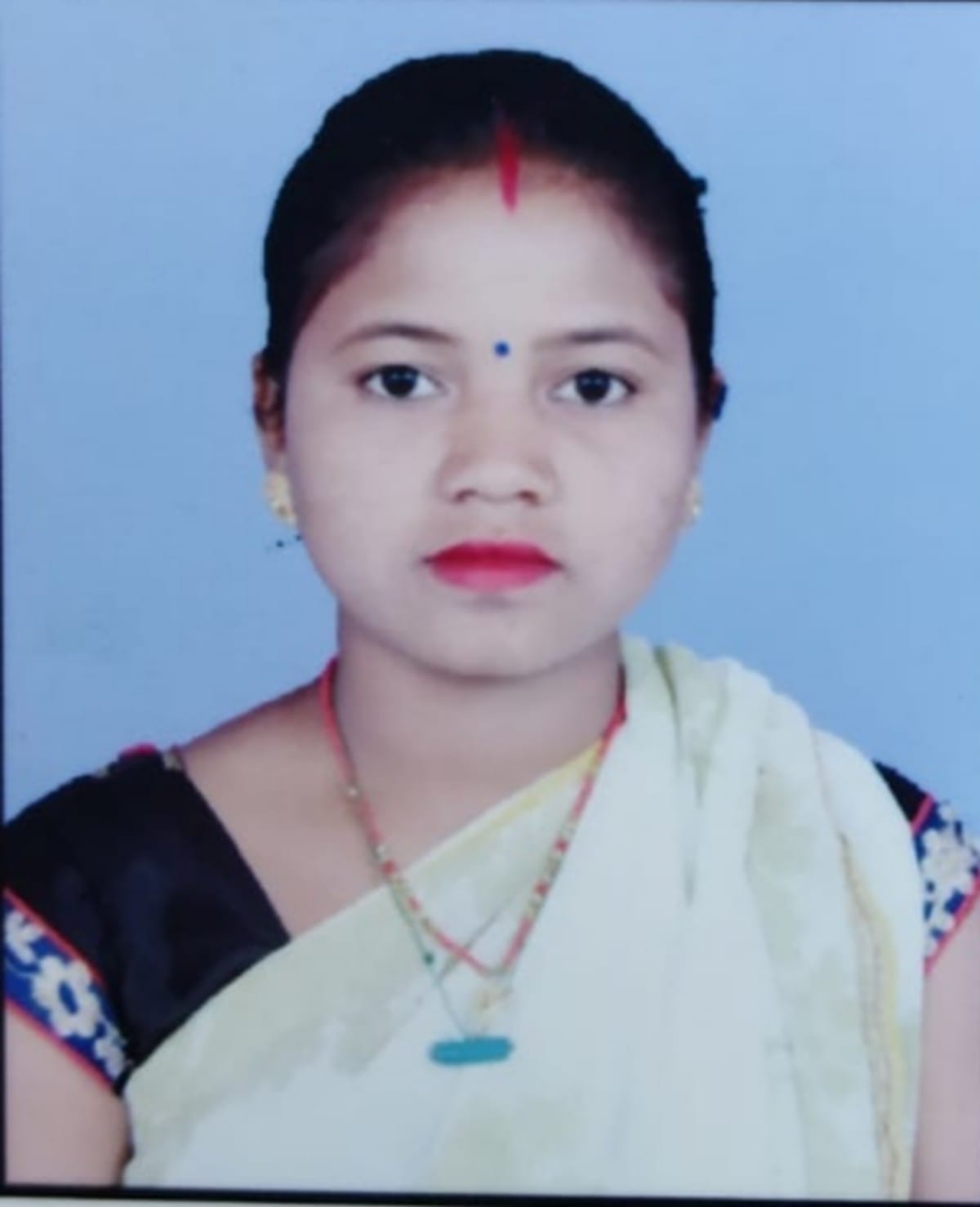 Married woman died burnt father allegation of murder fro dowry in sonbhadra