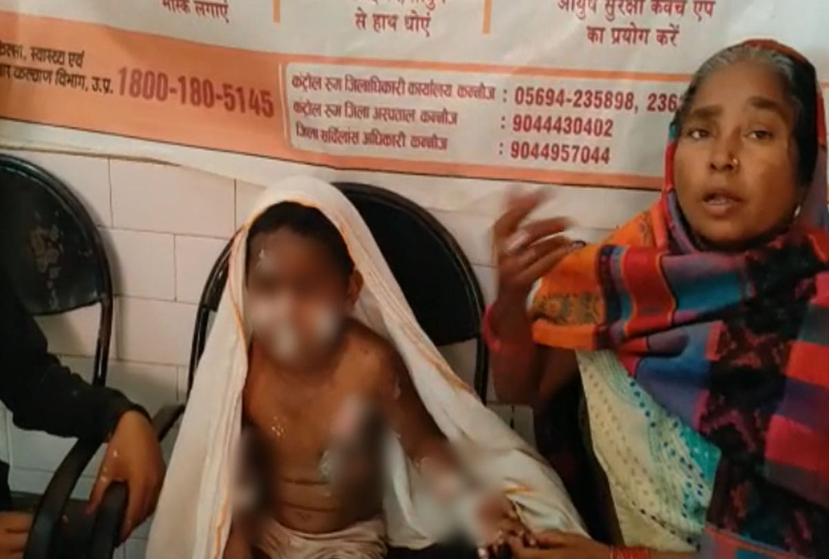 father throw boiling milk on daughter in kannauj
