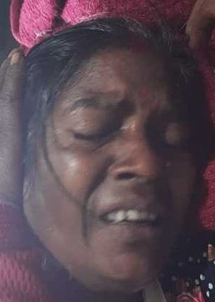 Woman seriously injured in pig attack in kanda bageshwar