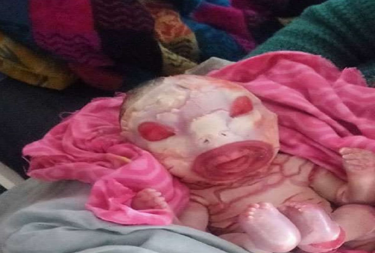 Gopalganj Bihar News : Alien Baby Born and died within hours