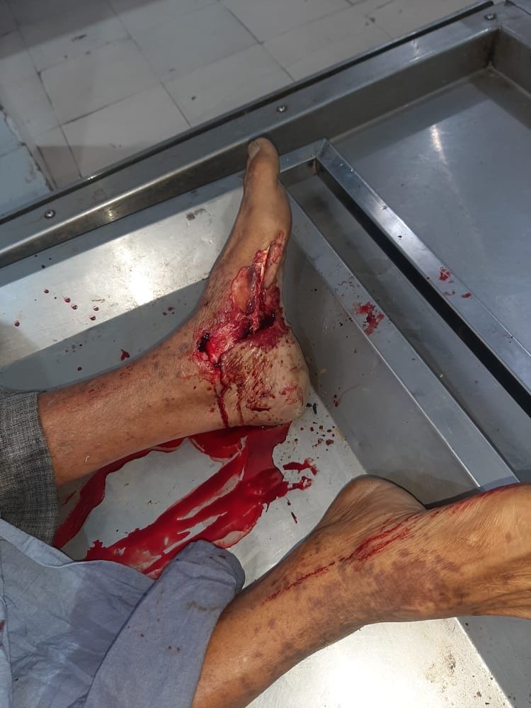 kundli border, death of farmer, mouse cut on dead body