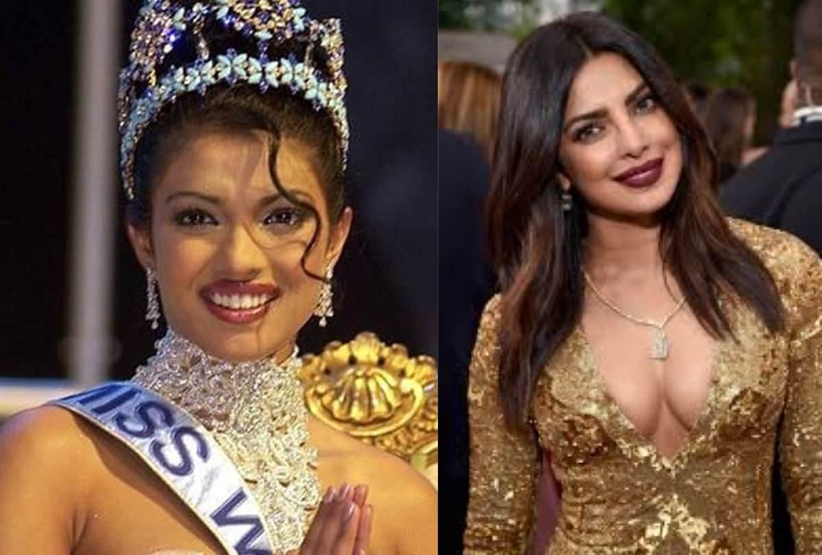 Priyanka Chopra Reveals That She Burnt Her Forehead With A Curling Iron Before The Miss World 2000 Pageant