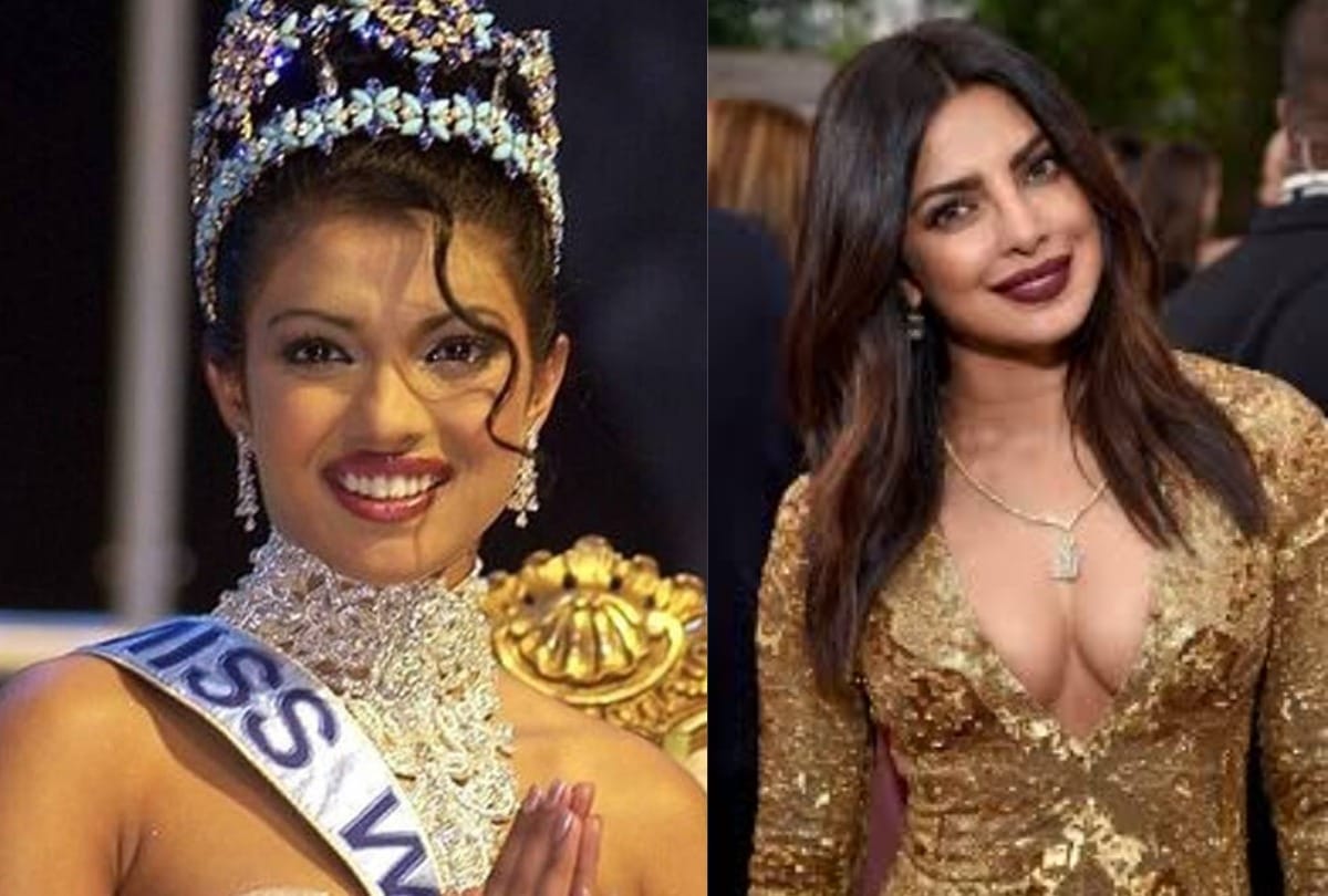 Priyanka Chopra Reveals That She Burnt Her Forehead With A Curling Iron Before The Miss World 2000 Pageant