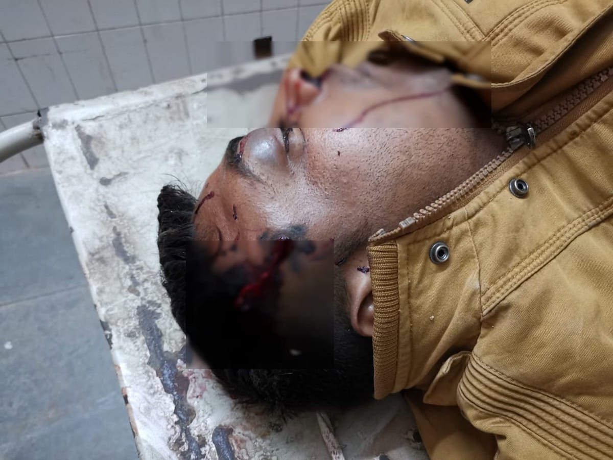 Constable injured by shot found in unconscious state in ghazipur