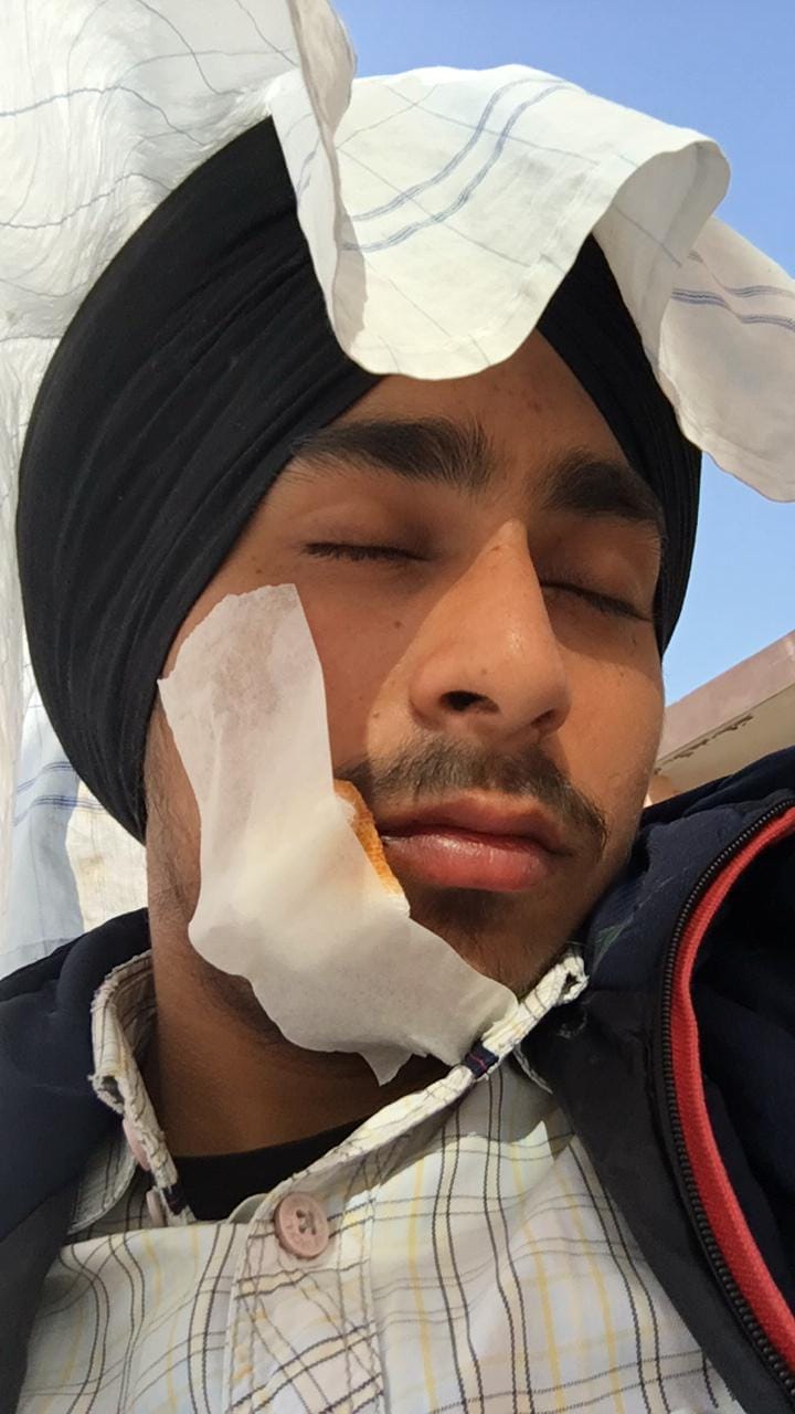 Bike rider injured from Chinese door, stitches