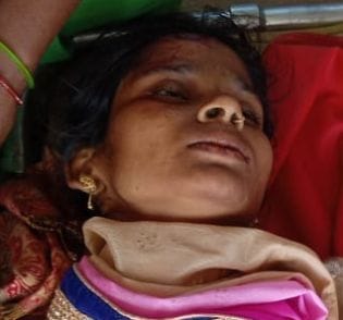 Truck riding woman crushed, serious