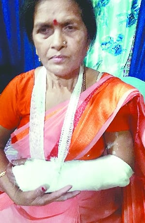 The woman broke her hand and looted her purse, collided with a divider and got injured