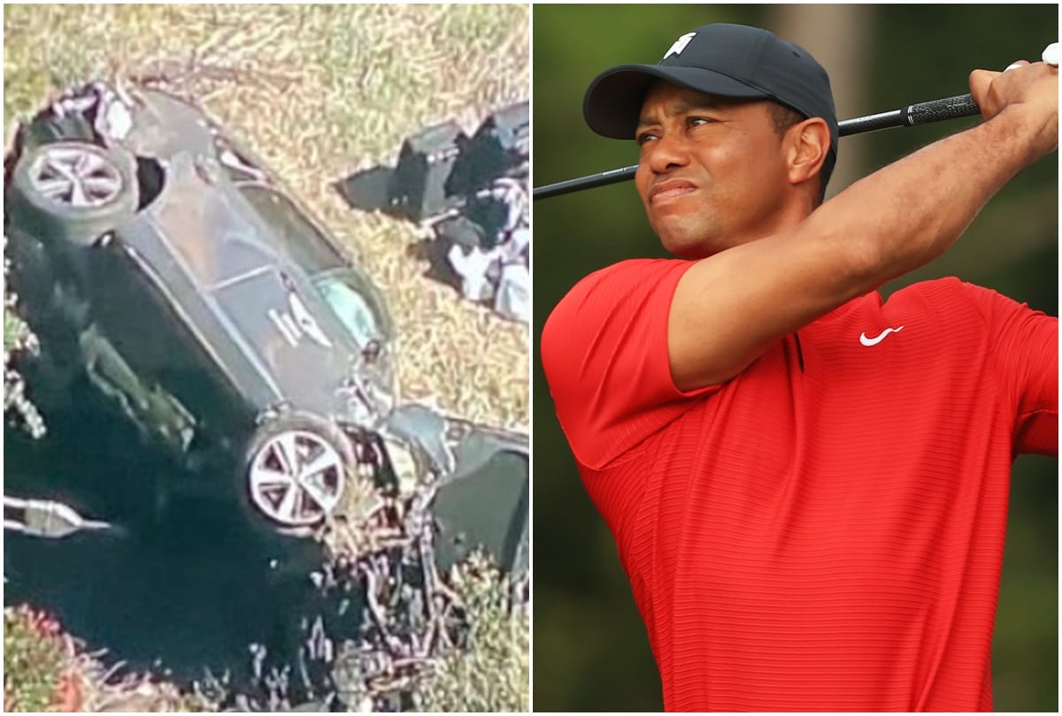 Golfer Tiger Woods hospitalized after car accident in Los Angeles