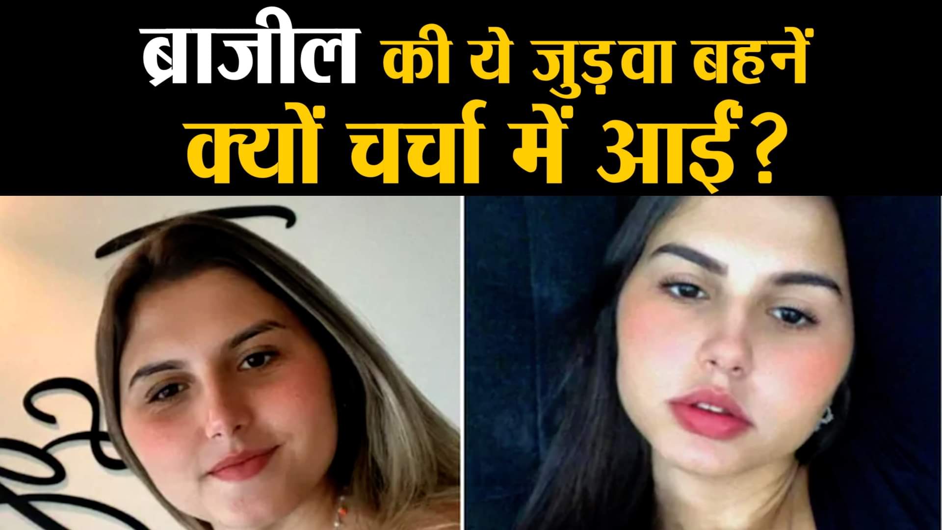 जेंडर कन्फर्मेशन सर्जरी