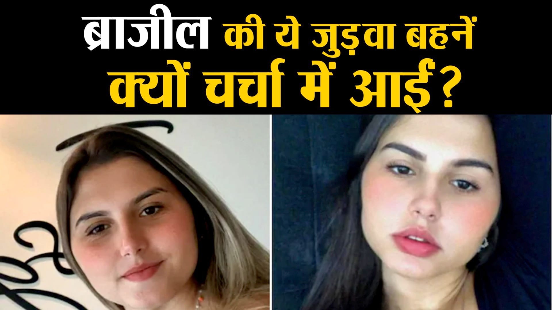 जेंडर कन्फर्मेशन सर्जरी