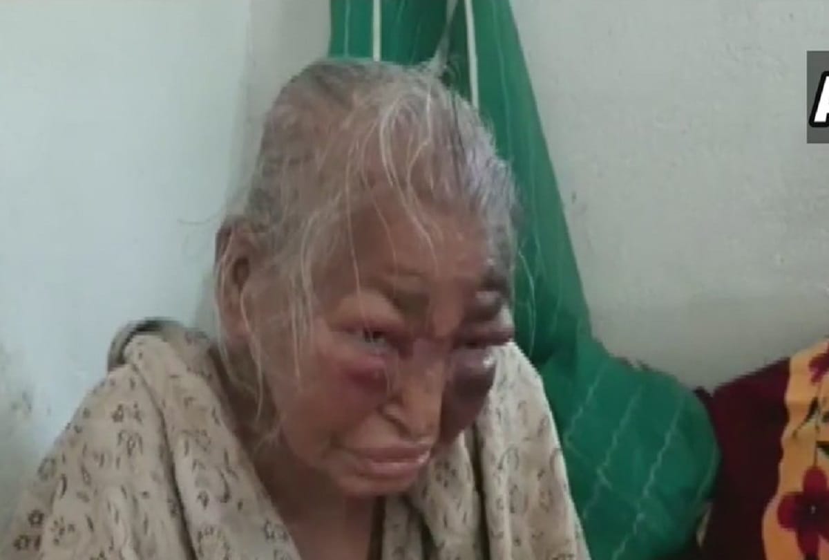 West Bengal elections 2021 : attack on bjp worker in North 24 Parganas, old mother is also brutally beaten up