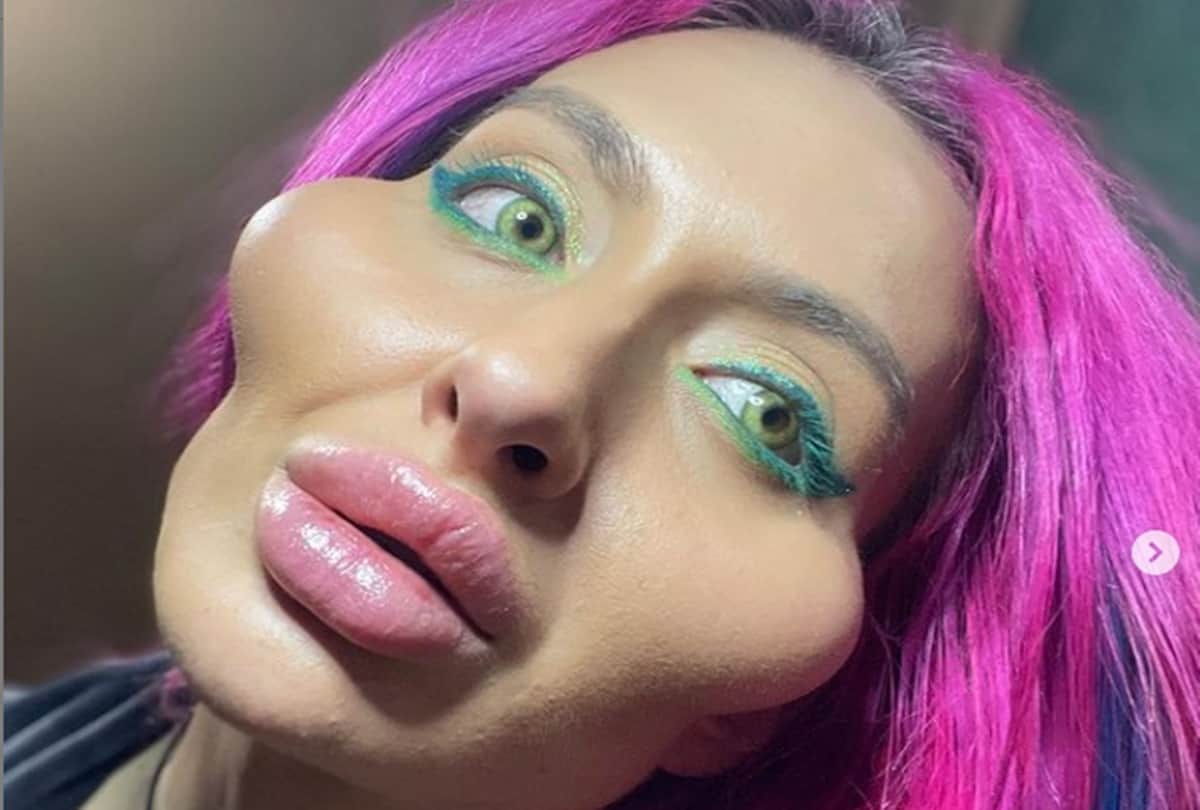 Ukrainian model Anastasia Pokreshchuk world biggest cheeks has shared a picture before cosmetic surgeries