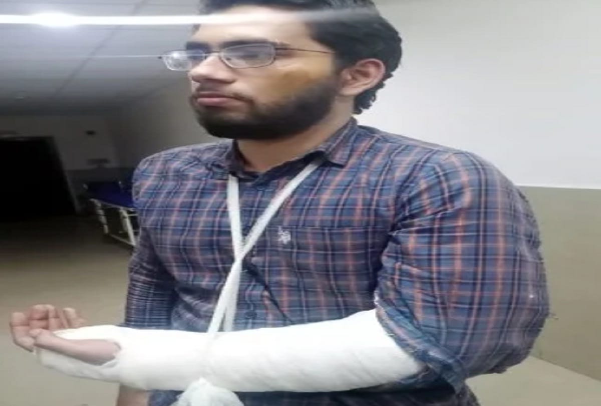 Resident doctor's broke hand in JN Medical College