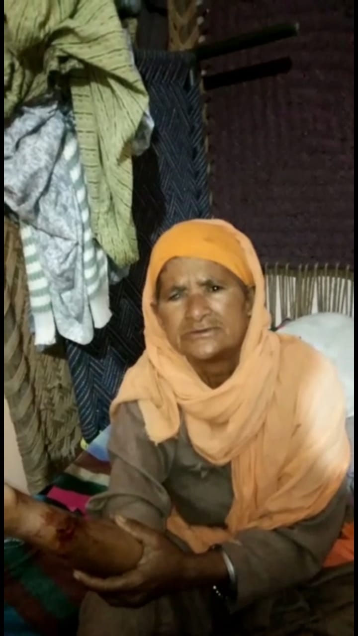 An stray dog bites an elderly woman