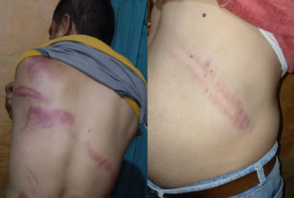 Miscreants Attack on forest inspector and forest guard