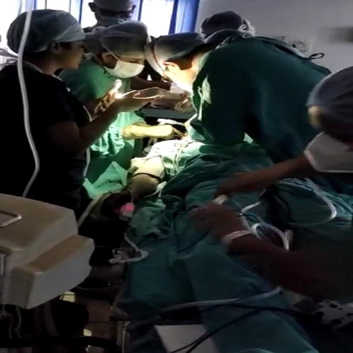 BHU hospital mobile flashlight surgery case: BHU administration statement information was given of power cut