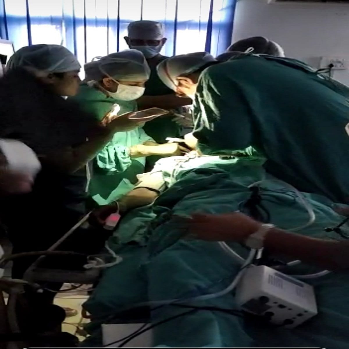 BHU hospital mobile flashlight surgery case: BHU administration statement information was given of power cut