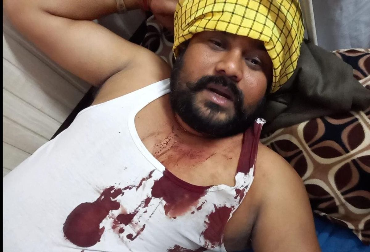 Two injured including Vice Chairman of Block Committee in fight