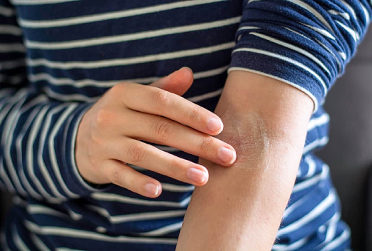 these skin changes can also be signs of covid infection