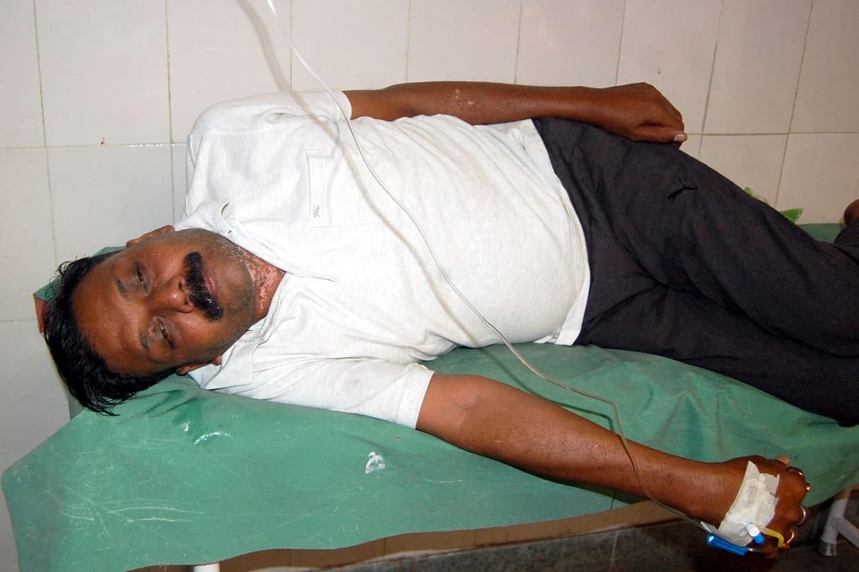 Prisoner serving life imprisonment consumed poison in jail