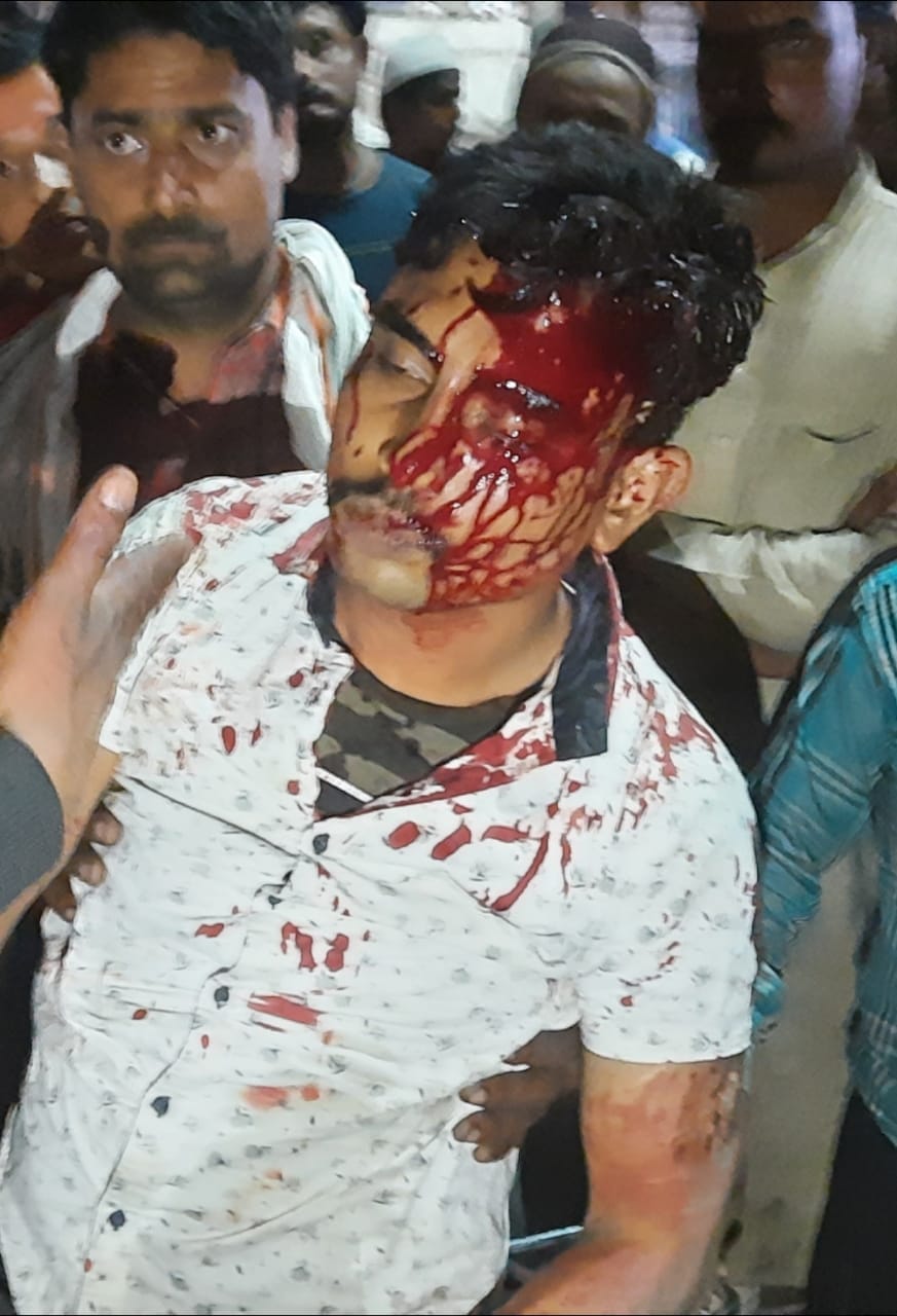 The youth accused of molestation was bled