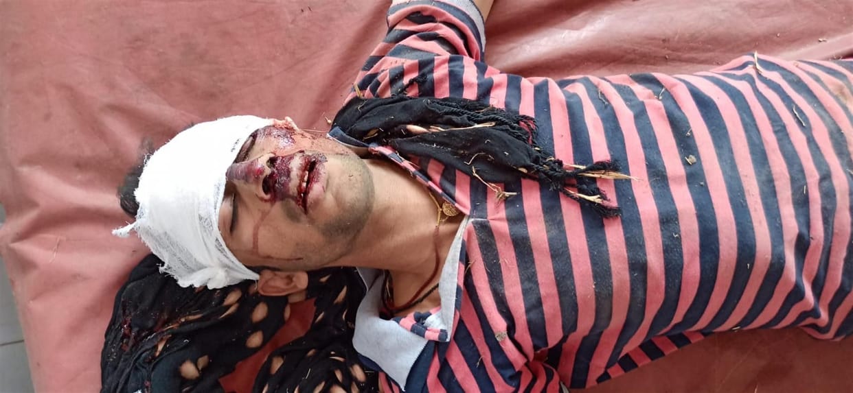 Hathras: vehicle kills bike riders, woman dies
