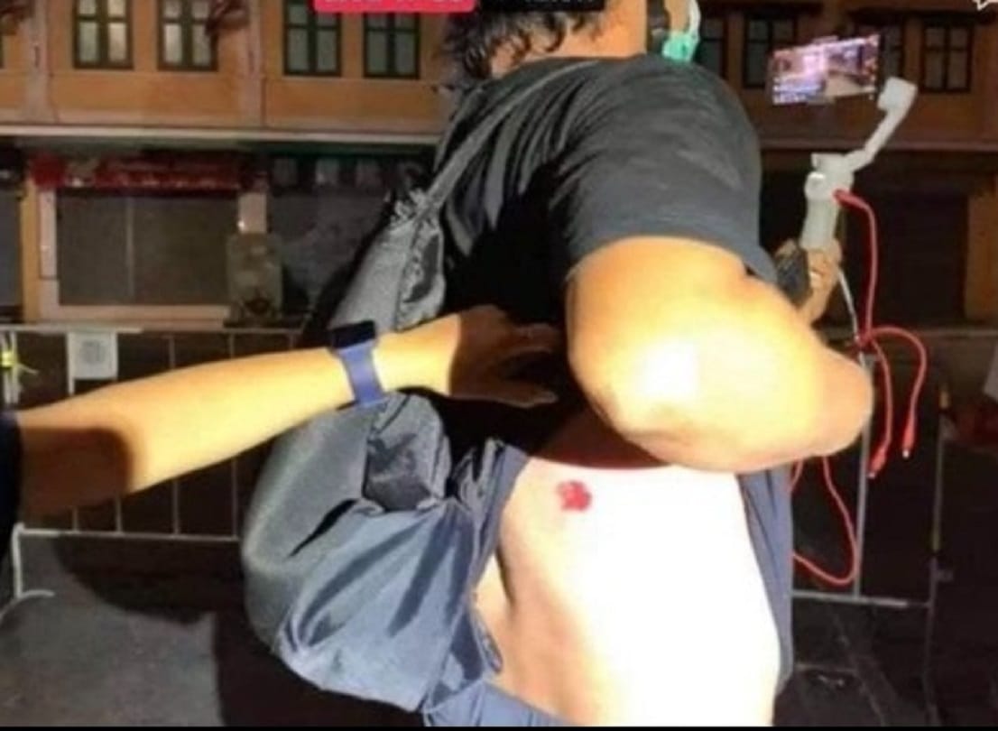 Thailand: Police fired rubber bullets at democracy supporters, many people injured