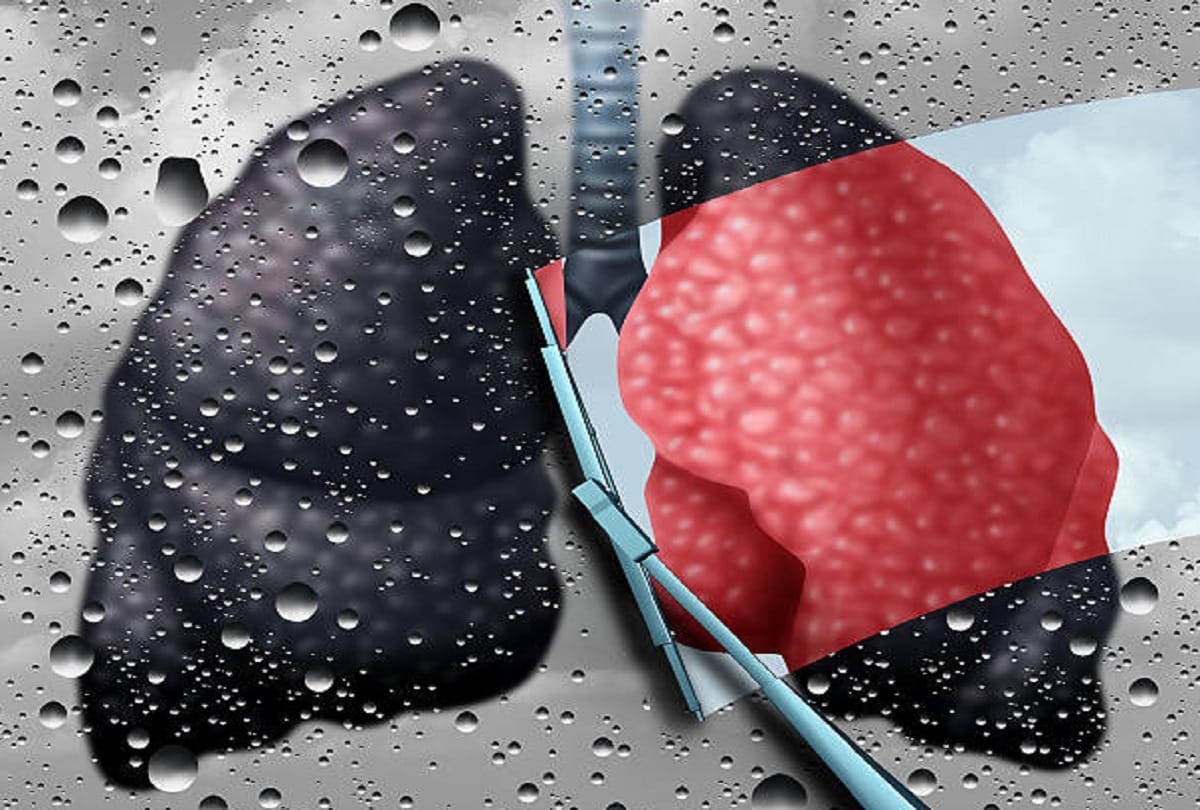 coal workers pneumoconiosis also known as Black Lung Disease Causes symptoms and prevention tips in hindi