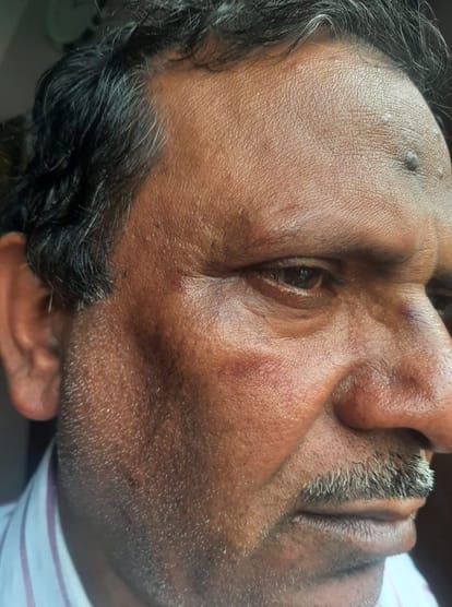 ग्रेटर नोएडा में लूटपाट का शिकार हुए भारतीय खेल प्राधिकरण के जीएम