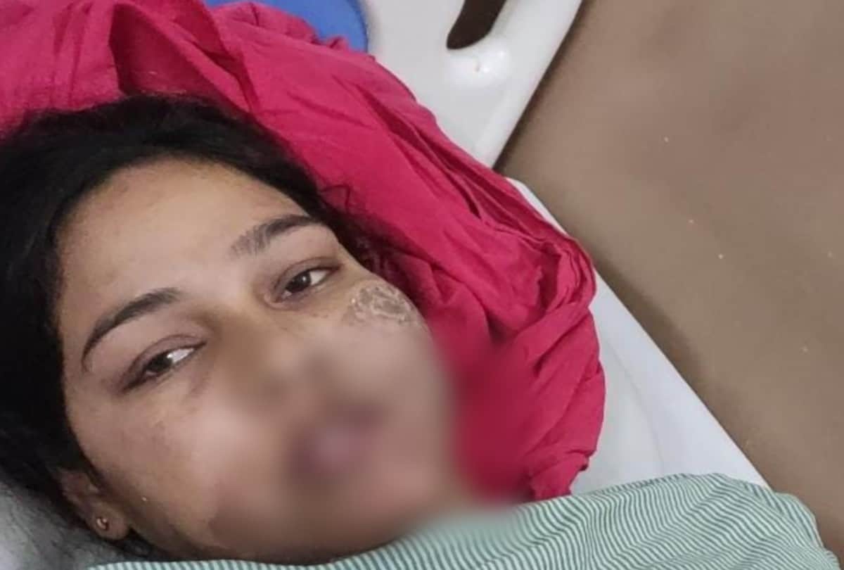 Acid Attack In Love Affair Young Man Died Crime News