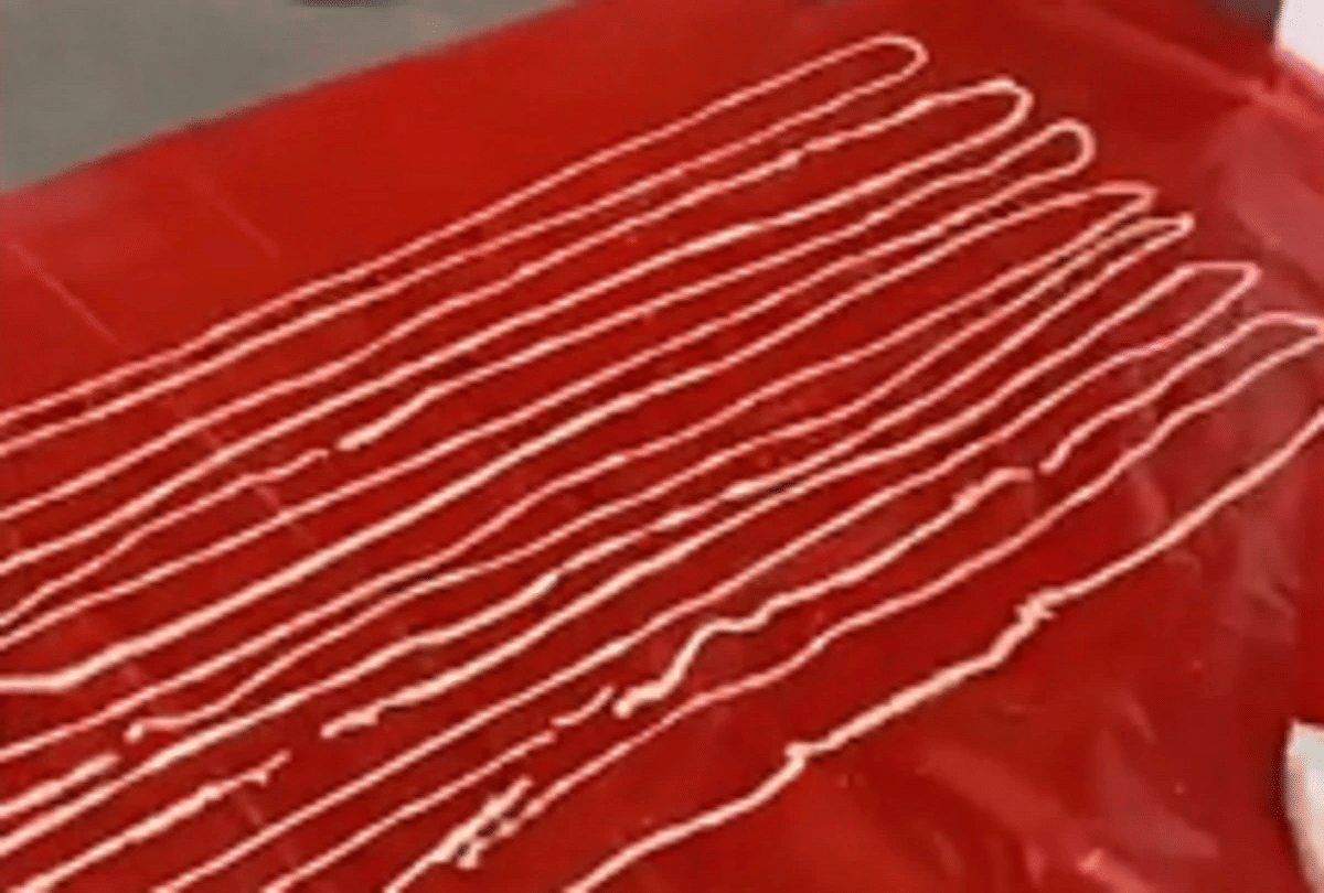 thailand 59 feet long tapeworm removed from mans rectum