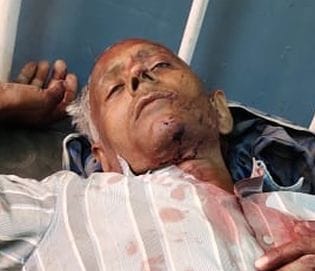 Sticks, stones gone, ten injured