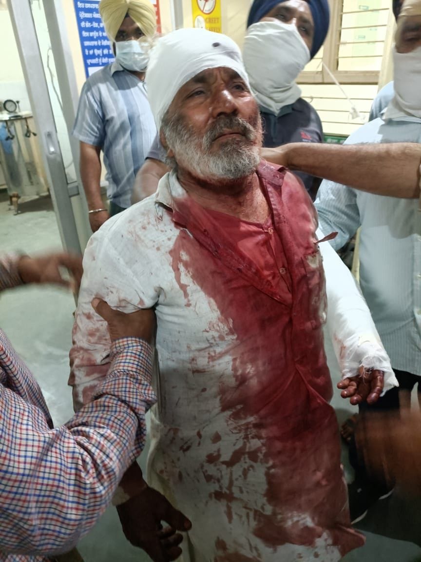 Bloody Holi .. Attack on two sons including father in Derabassi's village Paragpur, case registered on 18