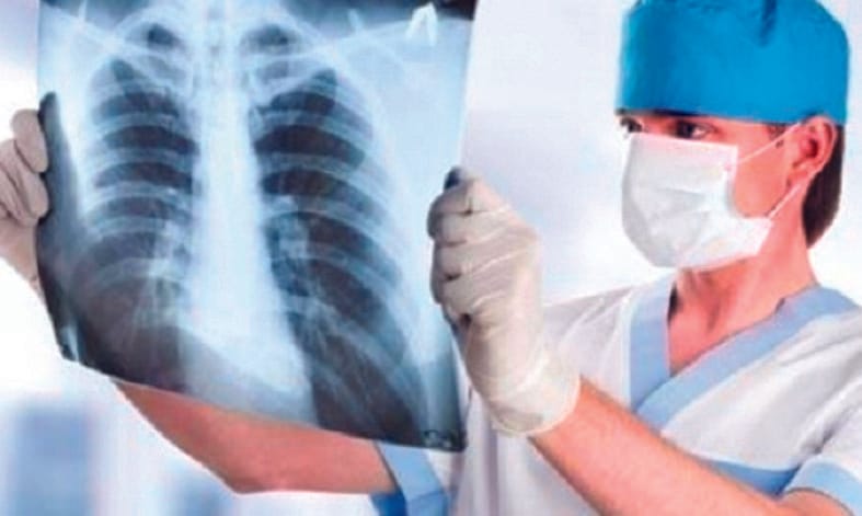 TB patients do not come to the hospital, medicine will be given at home