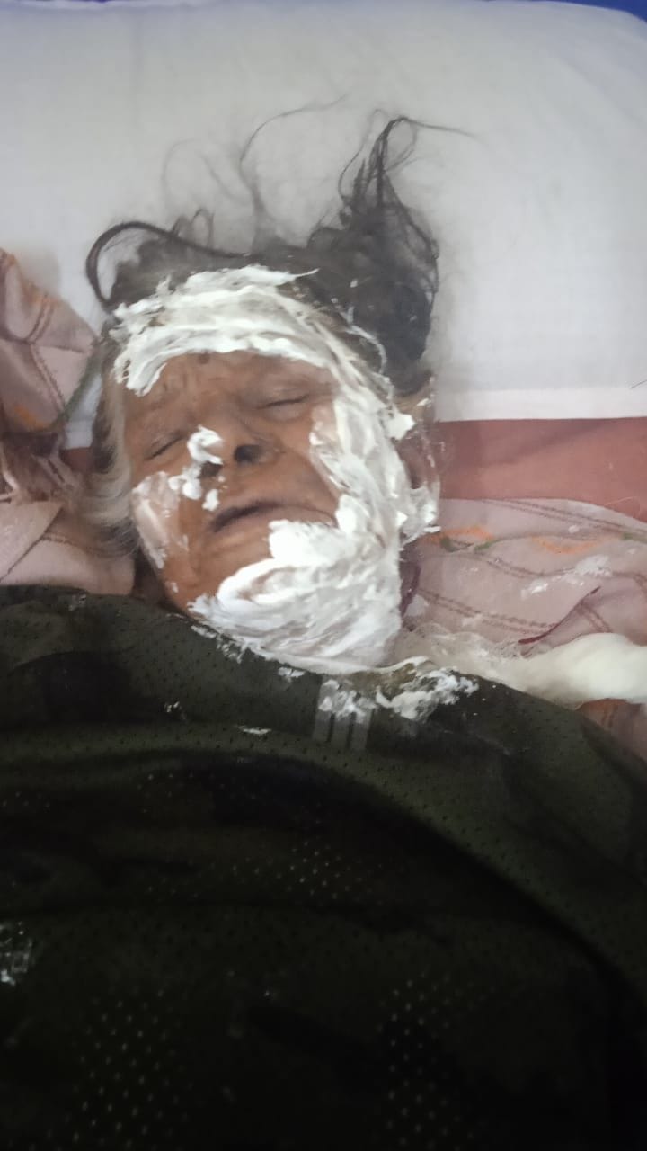 Granddaughters jumped in fire to save Ama