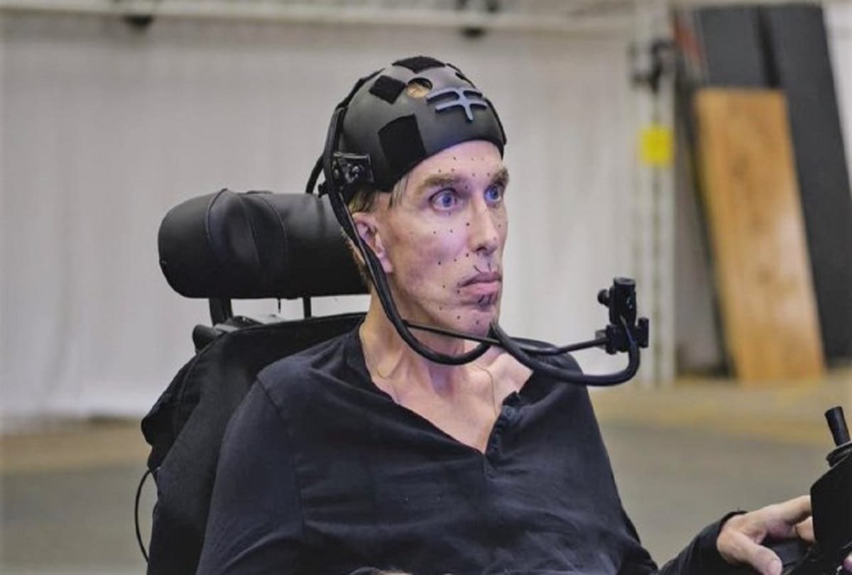 Scientist from Britain dr peter scott morgan transformed into worlds first Roboman after motor neurone disease