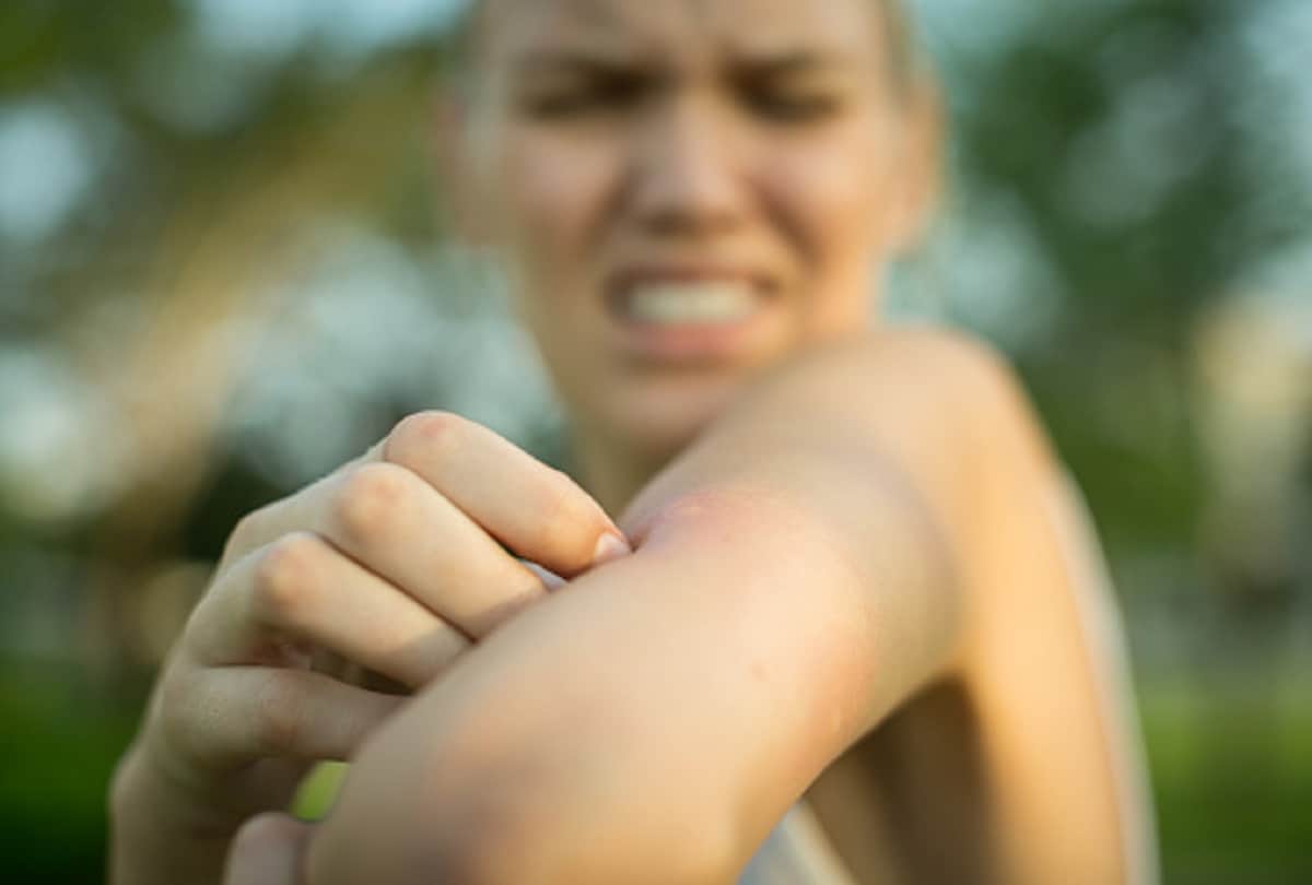 itching causes 5 reasons your skin itches uncontrollably