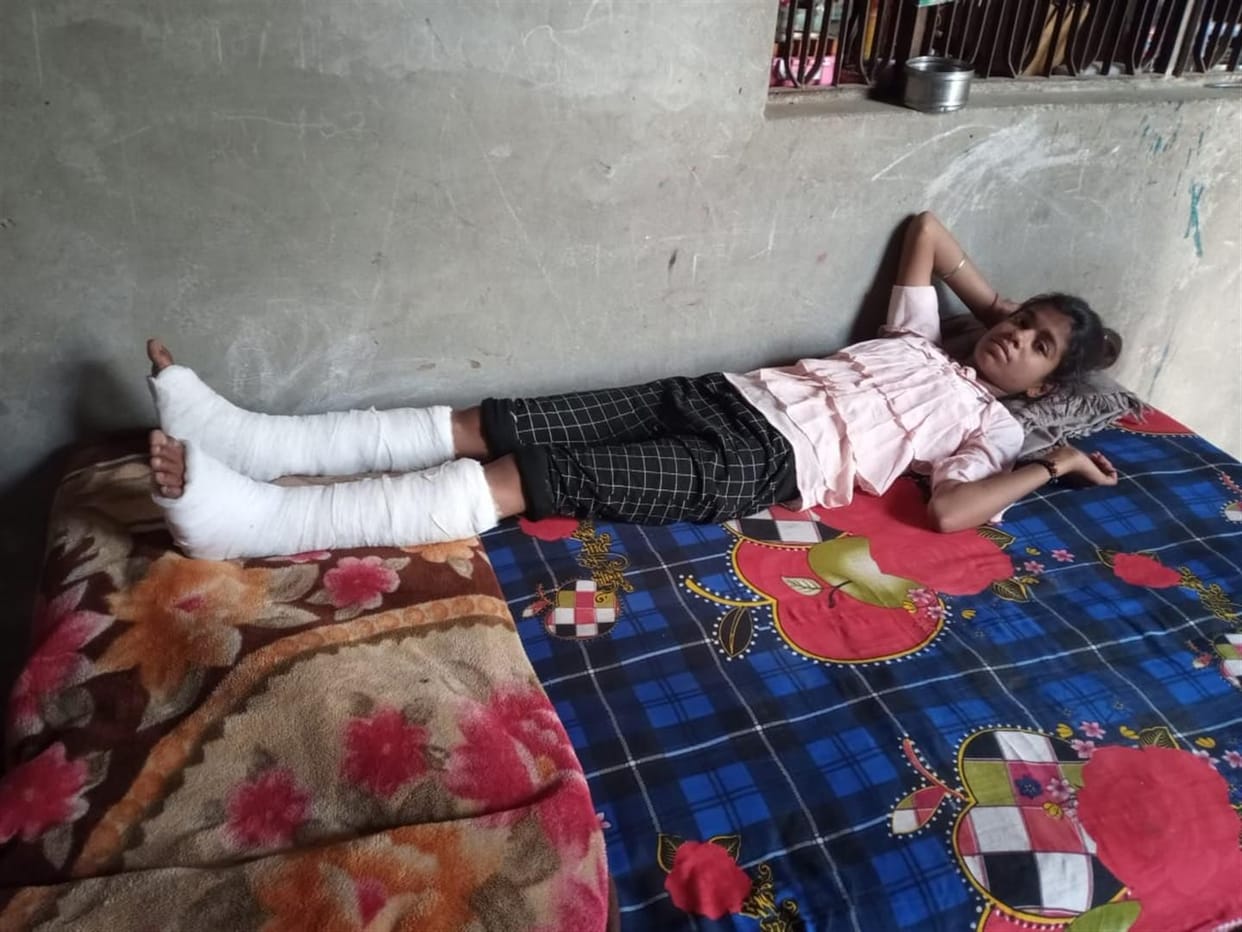 Hathras: Monkeys bite and injure a teenager and a teenager