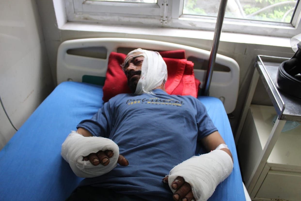 four farmers got injured in bears attack