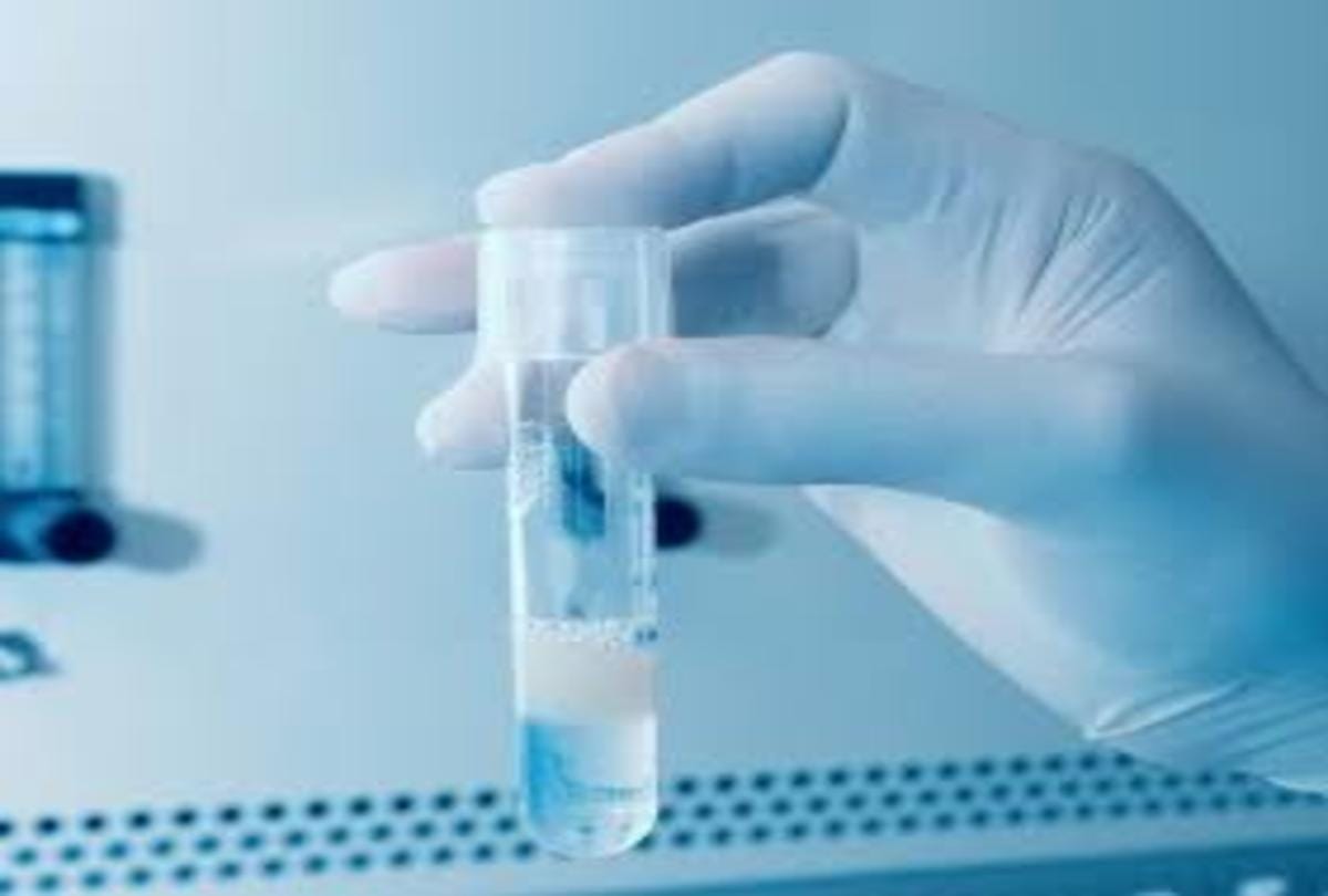 Sperm Bank in China News: Sperm Donor Get 56000 Rupees For Good Quality Sperm