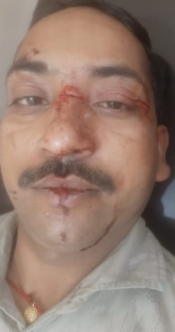Bike rider injured by being hit by hartman bridge