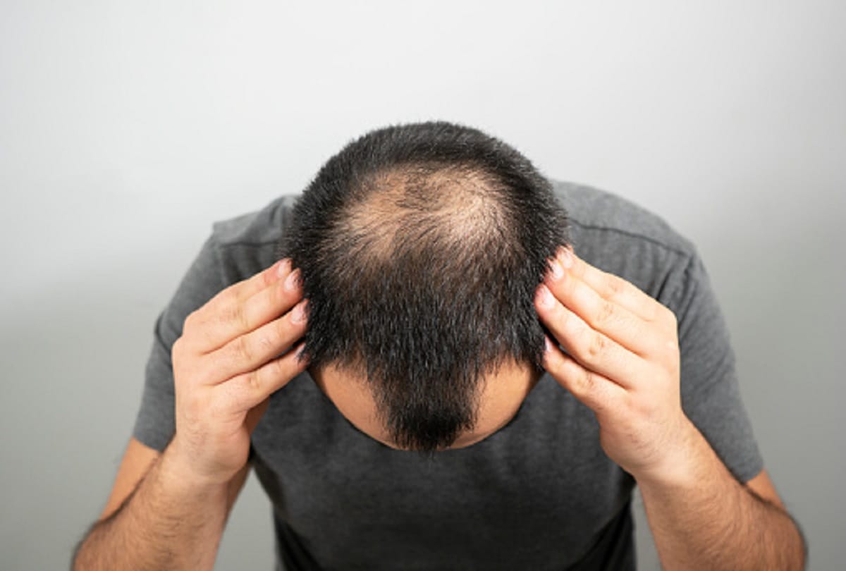 chronic stress leads to hair loss