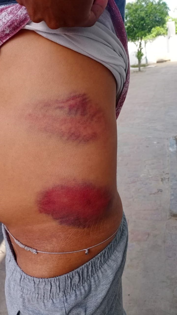 Three miscreants looted 1 lakh 24 thousand by attacking ATM and customer service center operator with sticks and rod